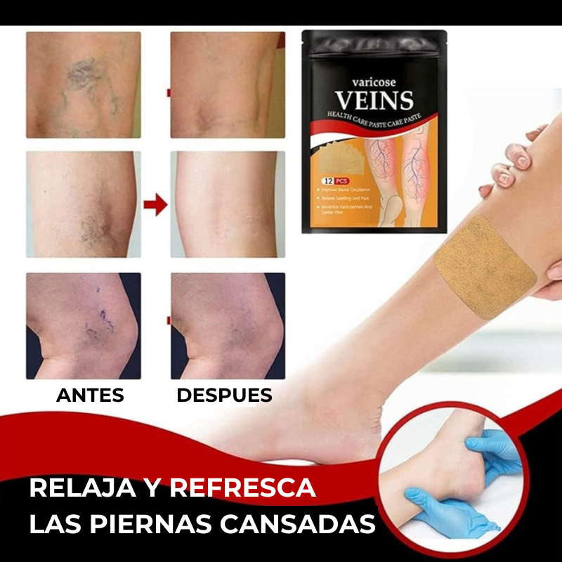 VEINS VARICOSE®-Parches de Varices.